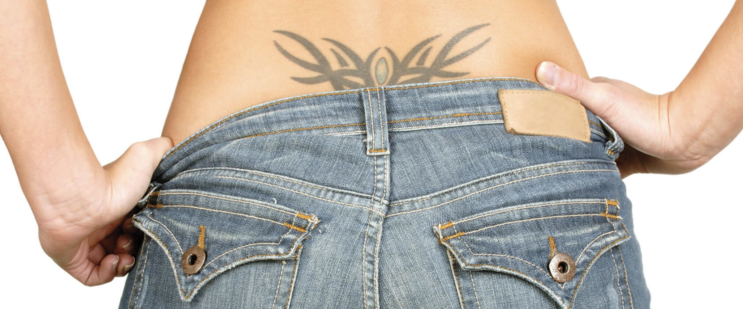 Laser tattoo removal treatment visual